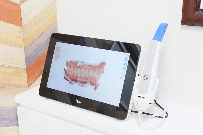 天王寺矯正歯科クリニックの設備 iTero（アイテロ）